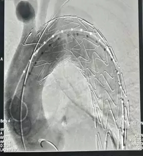 1031r22p64