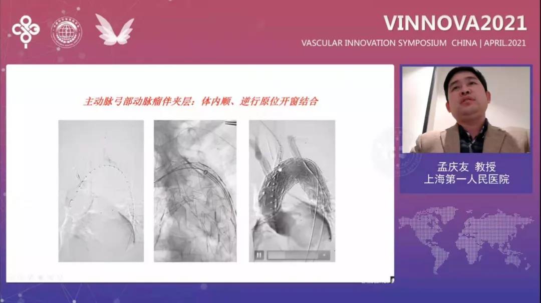 1621068vxx
