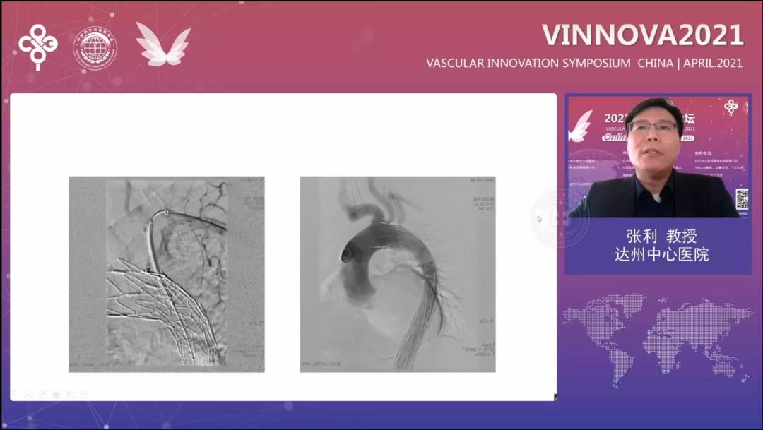 1621v2p2vf