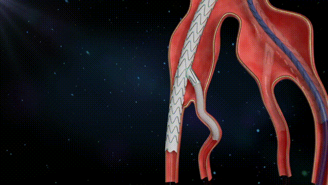 定稿.gif